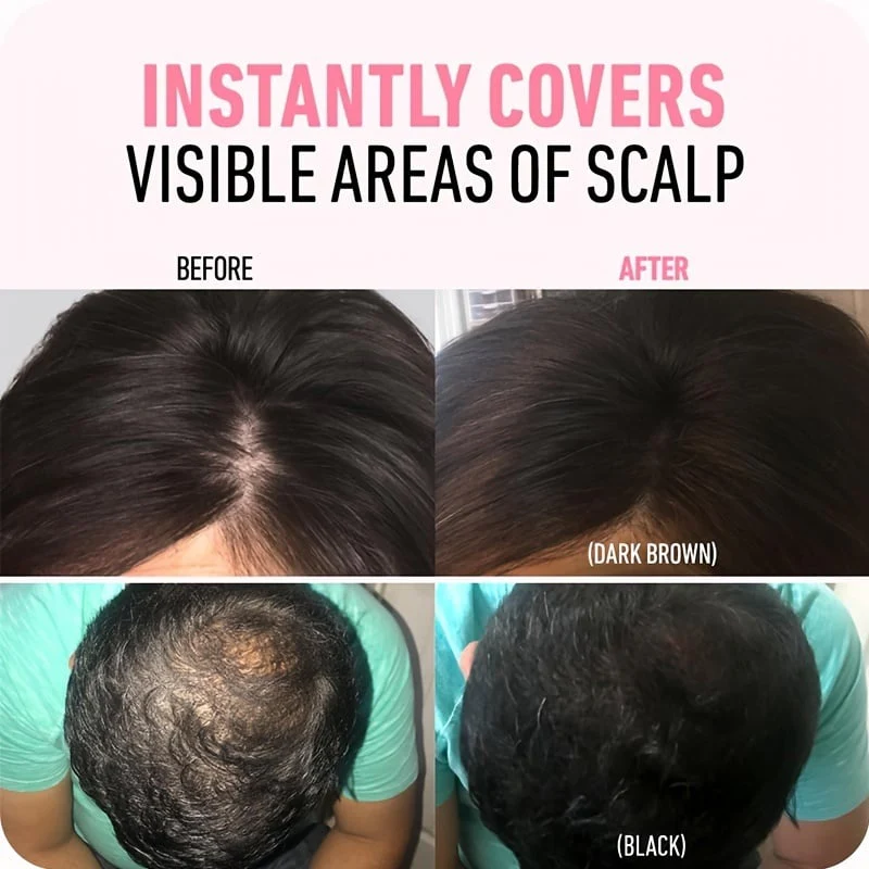 đ„Achetez 2 obtenez 1 gratuitđHairline Powder dissimule instantanĂ©ment la perte de cheveux, Root Touch Up Hair Powder - Image 8