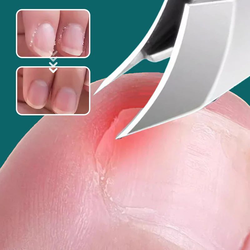 Coupe - ongles biseauté anti - éclaboussures Set de 3 (50% off) - Image 4
