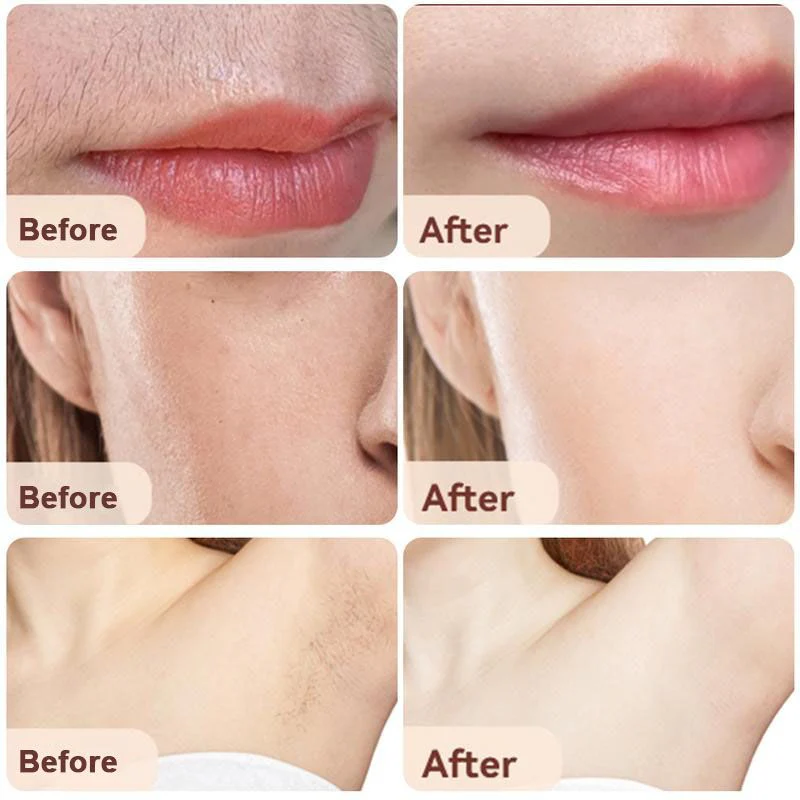 🔥Dernier jour 49% de réduction🔥2 en 1 Épilateur Facial et Tondeuse à Sourcils - Image 6