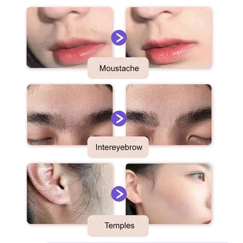 🔥2025 ventes chaudes🔥Crème d'épilation douce et non douloureuse pour le visage - Image 6
