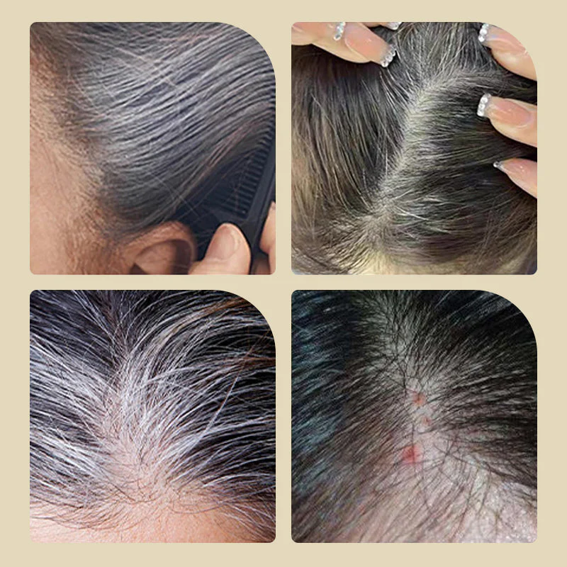 📢📢Achetez-en 2，obtenez-en 1 gratuit⏰Teinture Capillaire Sûre et Pratique avec Peigne - Image 2
