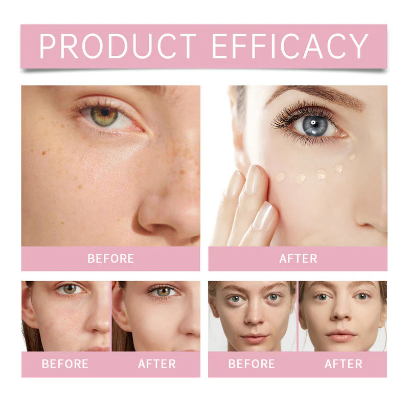Crème éclaircissante pour le contour des yeux & Crème éclaircissante anti-cernes - Image 2