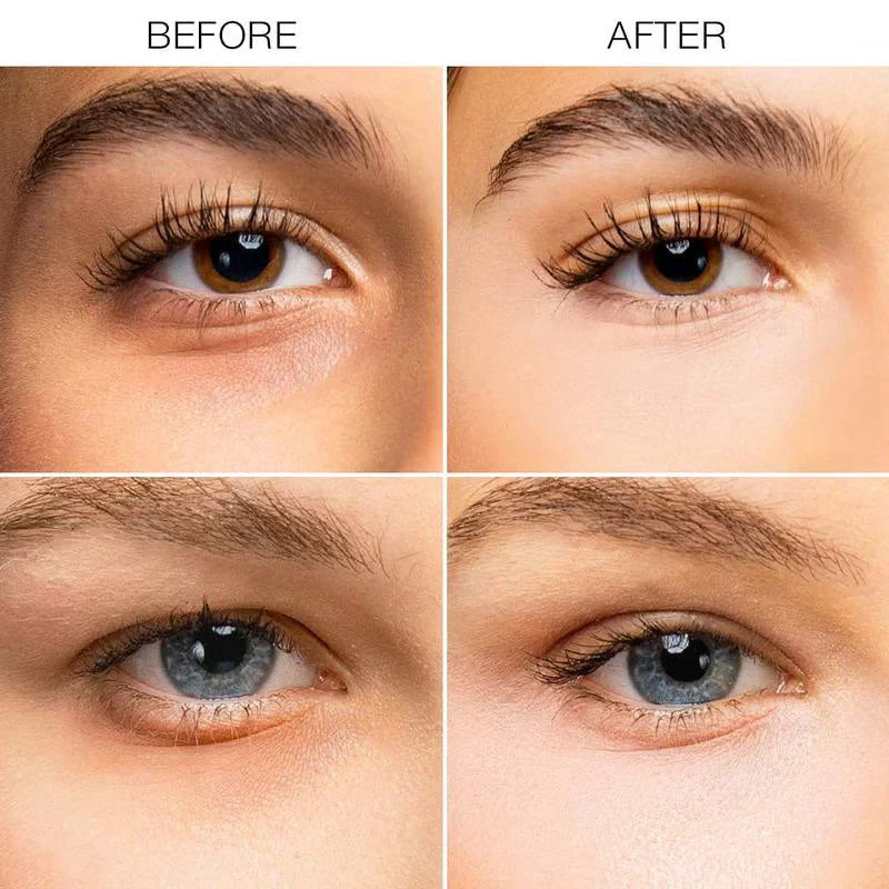 Crème éclaircissante pour le contour des yeux & Crème éclaircissante anti-cernes - Image 3