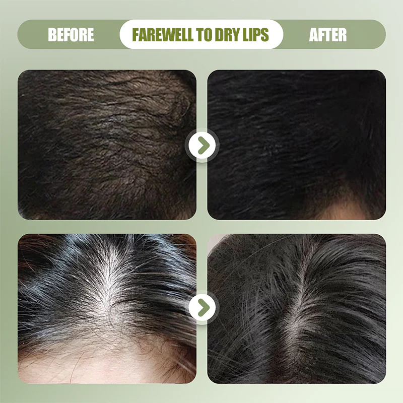 💥50 % de réduction⏰Shampooing Solide Renforçant à la Composition Naturelle🧼 - Image 2