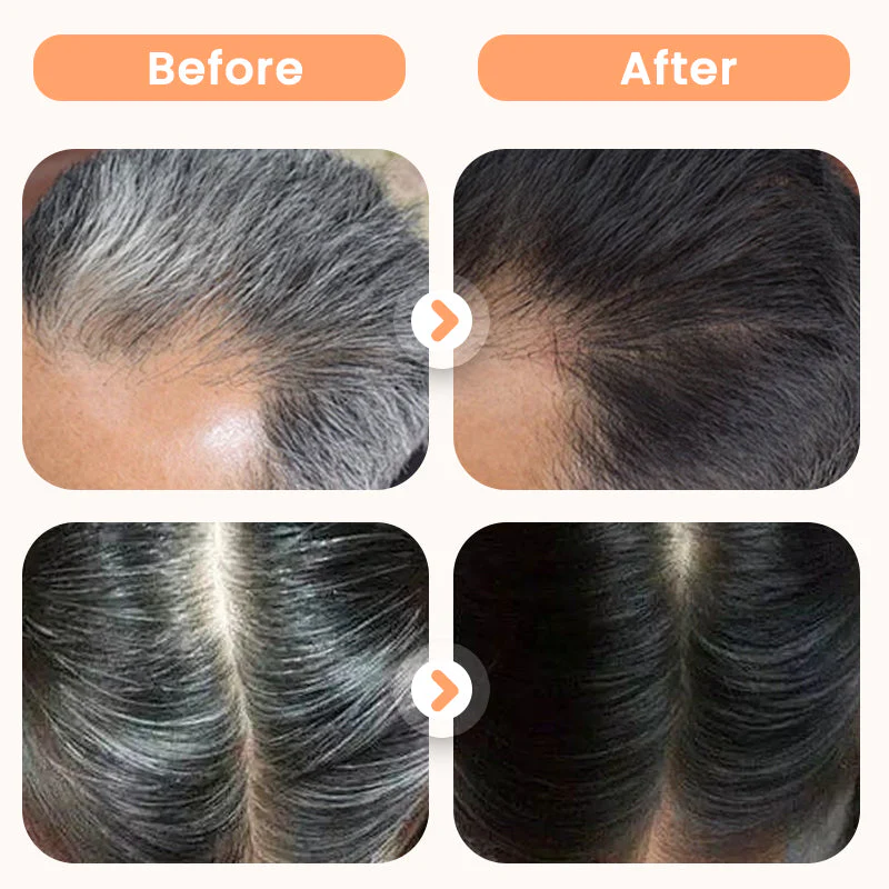 đââïžđż Teinture Capillaire aux Extraits VĂ©gĂ©taux pour Cheveux Blancs - Image 4