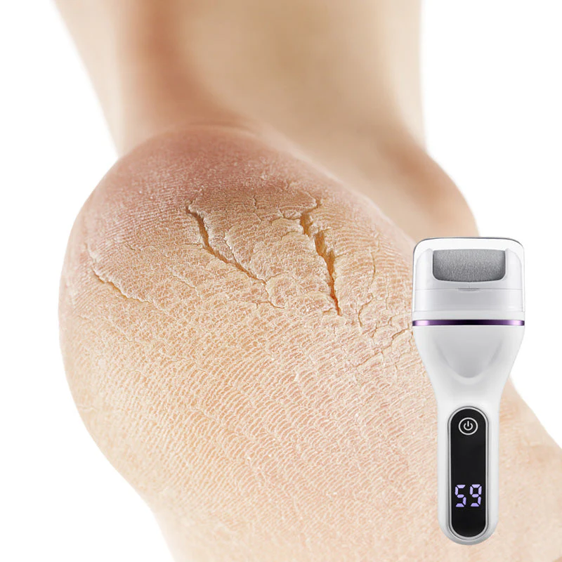 🏆75% de réduction pour une durée limitée✨🌸Portable Electric Foot Callus Remover - Image 8