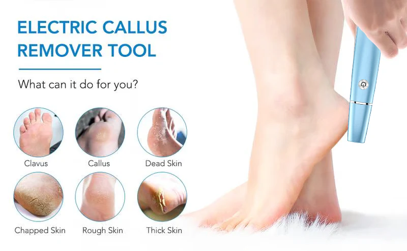 Extracteur de callosités électrique pour les pieds - Image 10