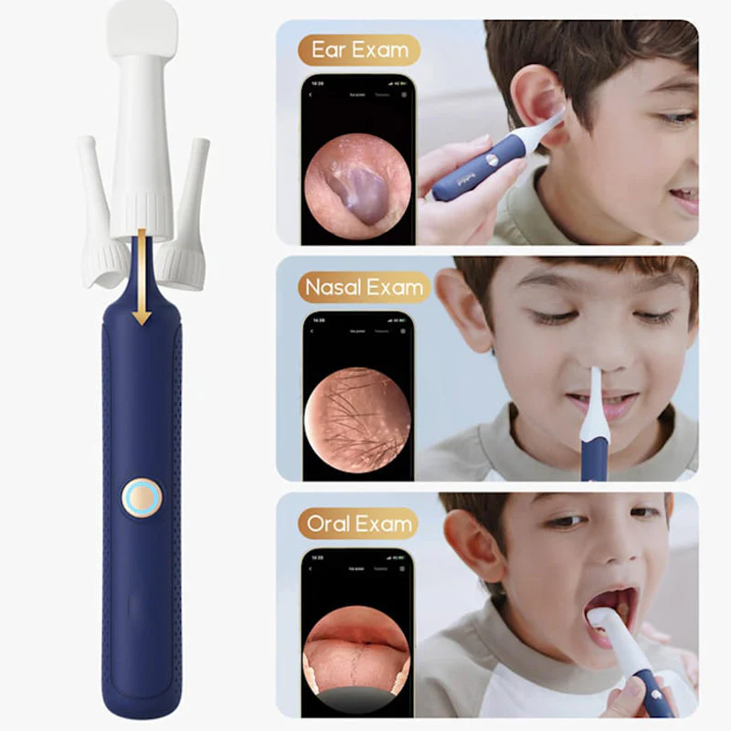⏳66% de réduction pour une durée limitée🔥Kit d'élimination du cérumen Visual Curved(🔥50% de réduction) - Image 4
