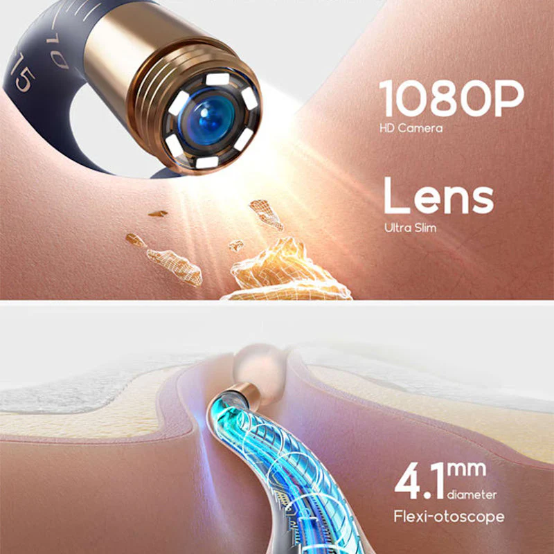 ⏳66% de réduction pour une durée limitée🔥Kit d'élimination du cérumen Visual Curved(🔥50% de réduction) - Image 5